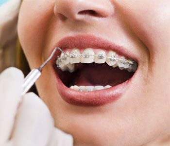 Kavanoor Dental Clinic & Orthodontics Center