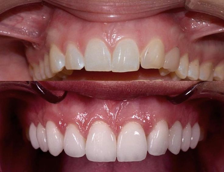 Kavanoor Dental Clinic & Orthodontics Center