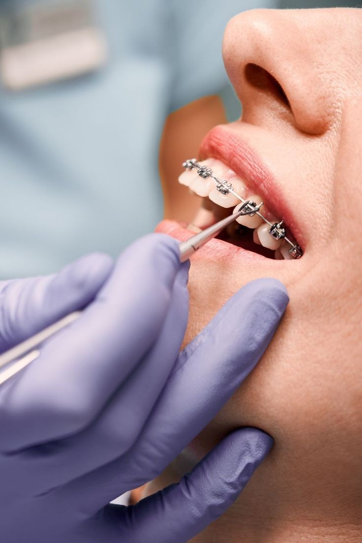 Kavanoor Dental Clinic & Orthodontics Center